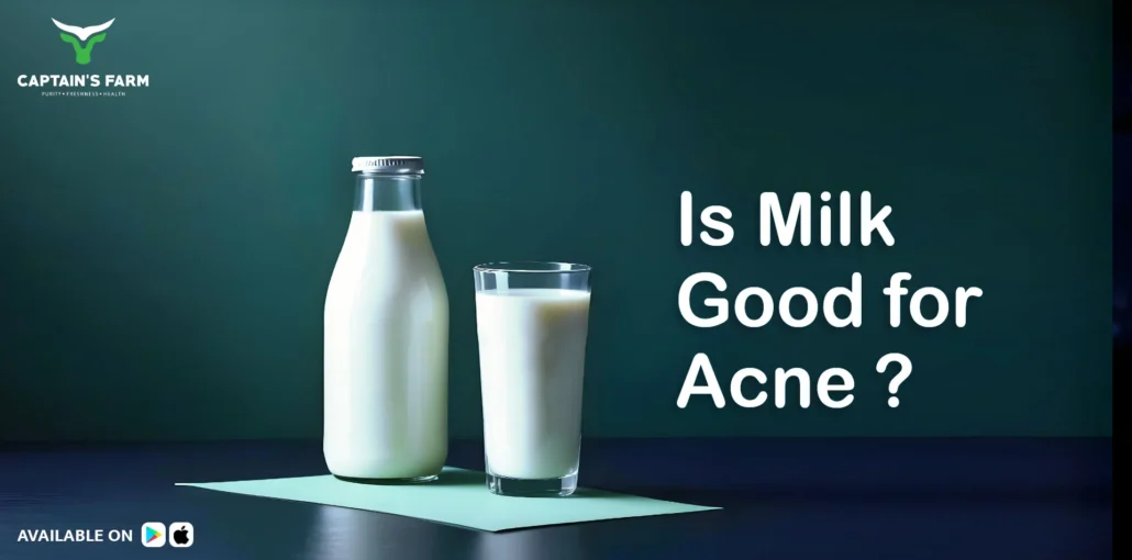 milk and acne concerns,